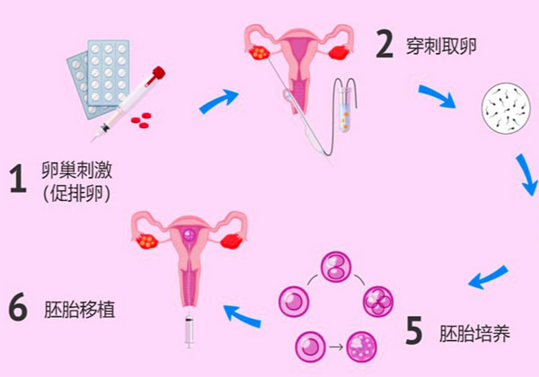 试管婴儿取卵前的准备1