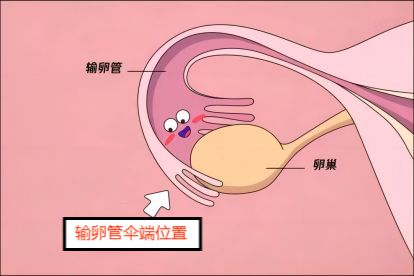 输卵管结扎能做试管婴儿吗？女人结扎做试管成功率高吗