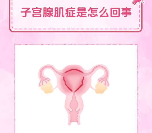 子宫腺肌症做试管婴儿费用高吗？成功率有多少
