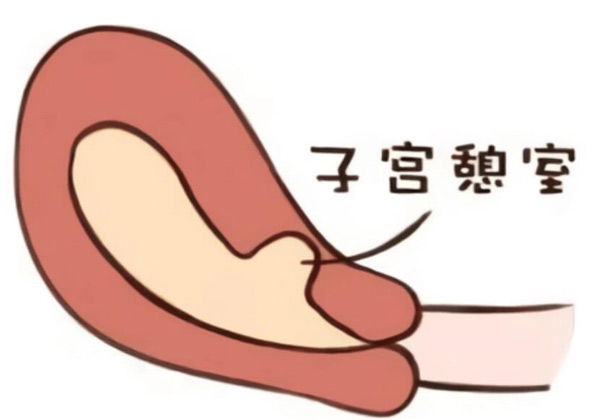 子宫9.jpg