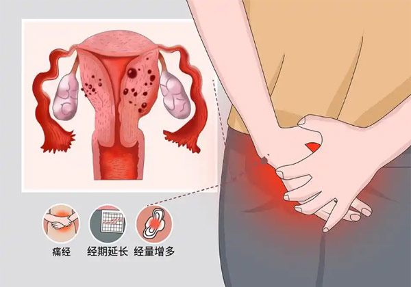 子宫.jpg